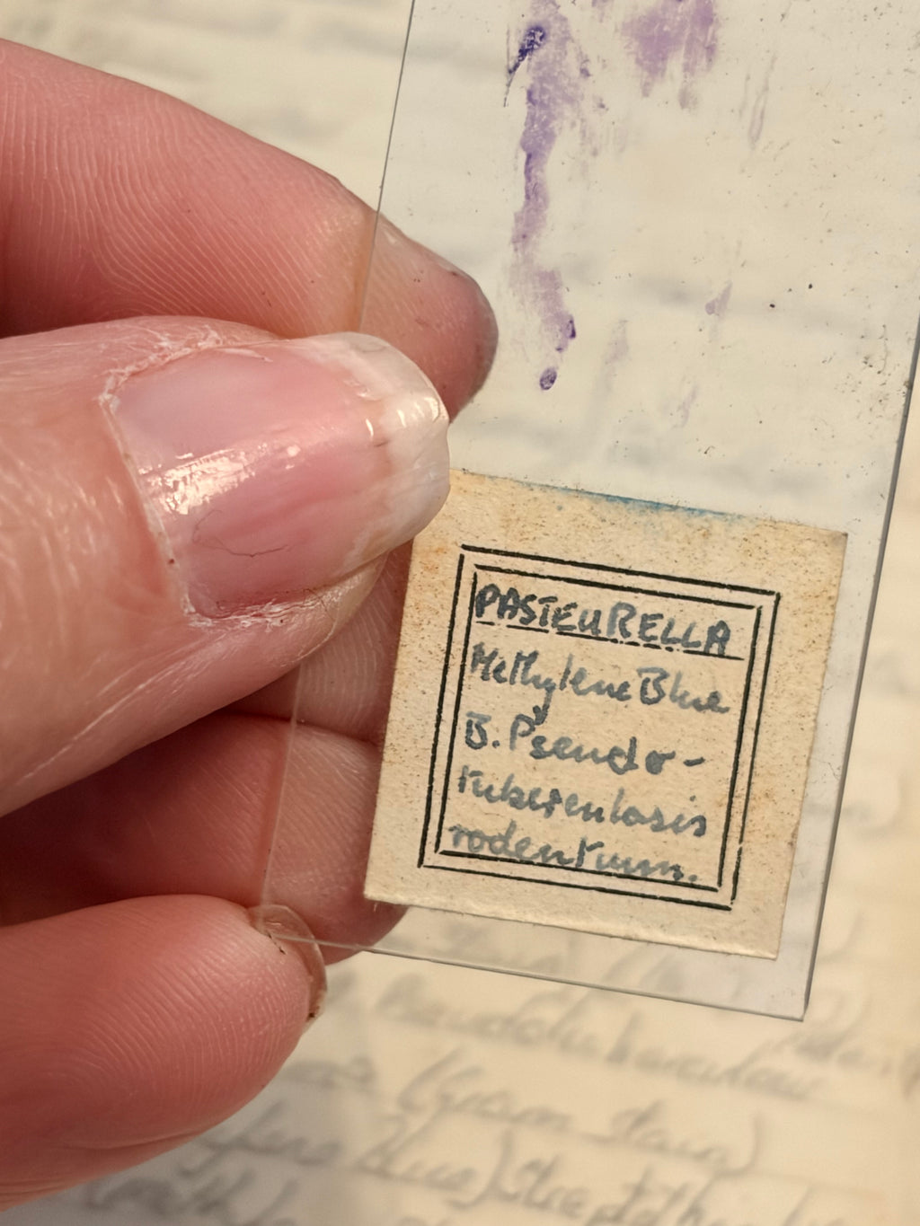 Antique Microscope Preparations - pathology slides