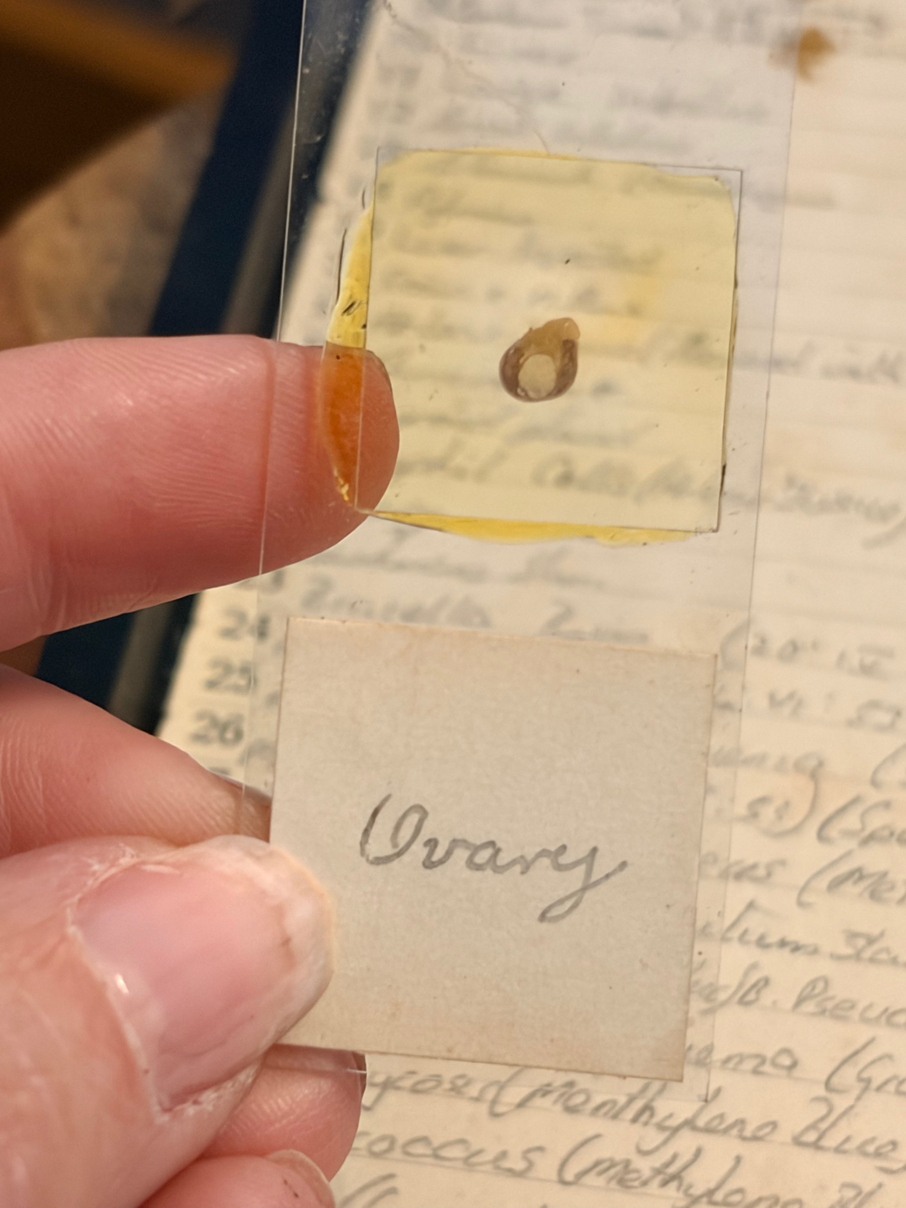 Antique Microscope Preparations - pathology slides