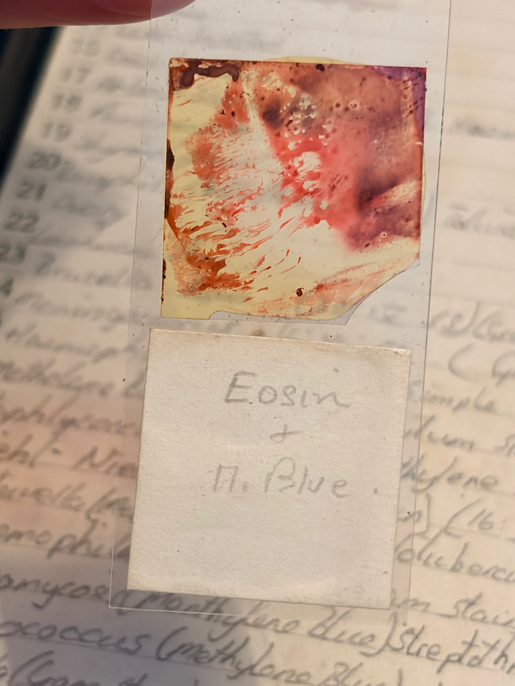 Antique Microscope Preparations - pathology slides