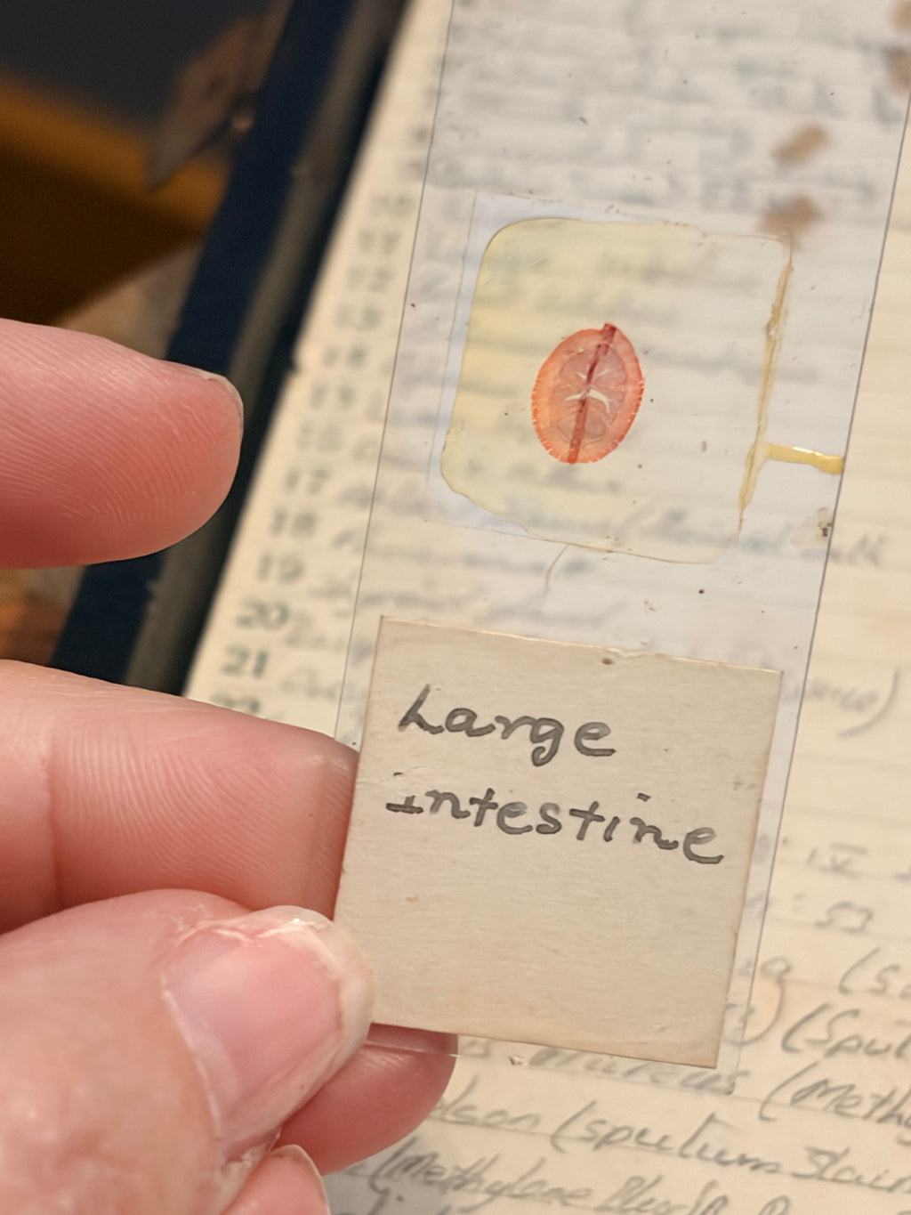 Antique Microscope Preparations - pathology slides