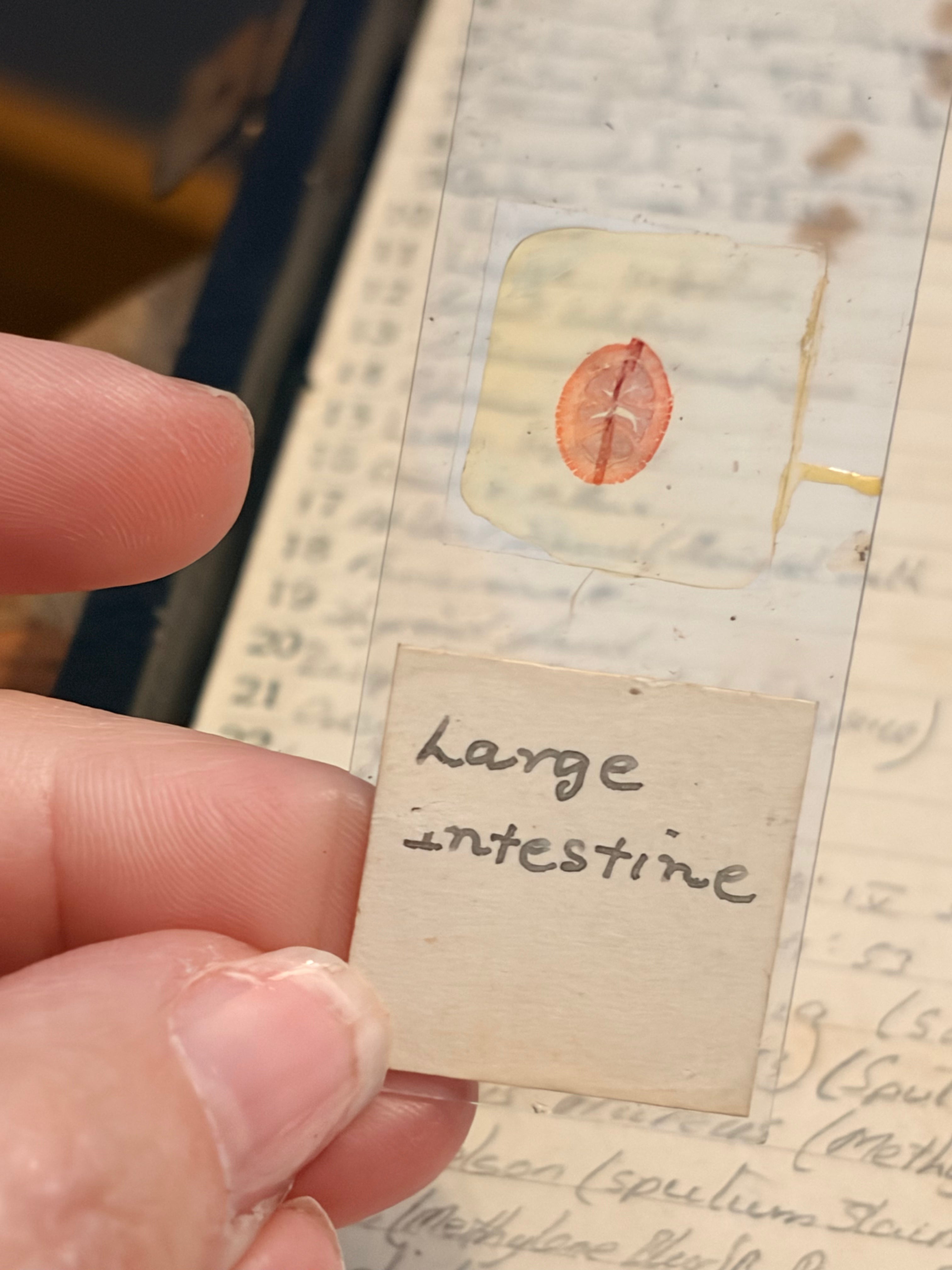 Antique Microscope Preparations - pathology slides